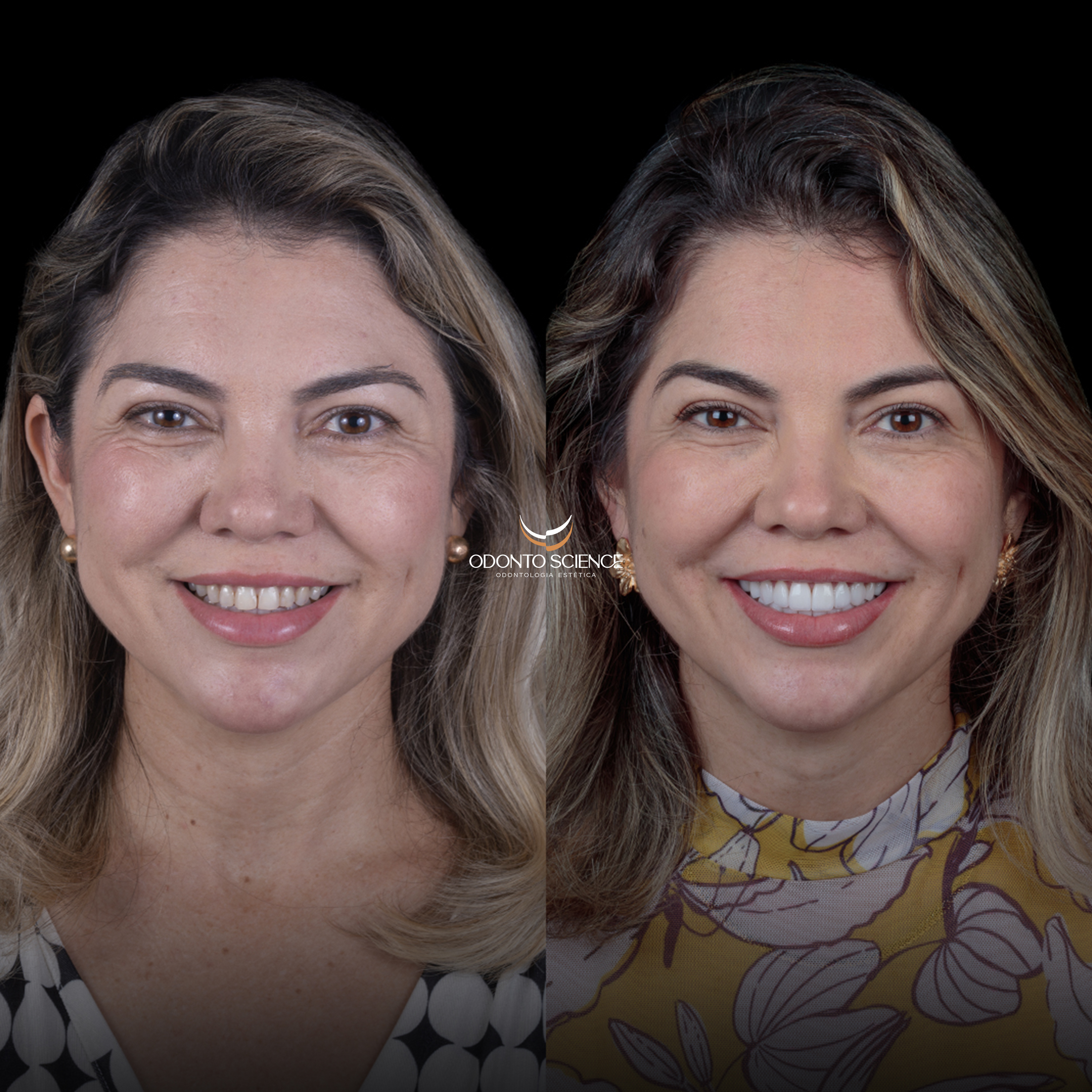 CRISTINA ANTES E DEPOIS