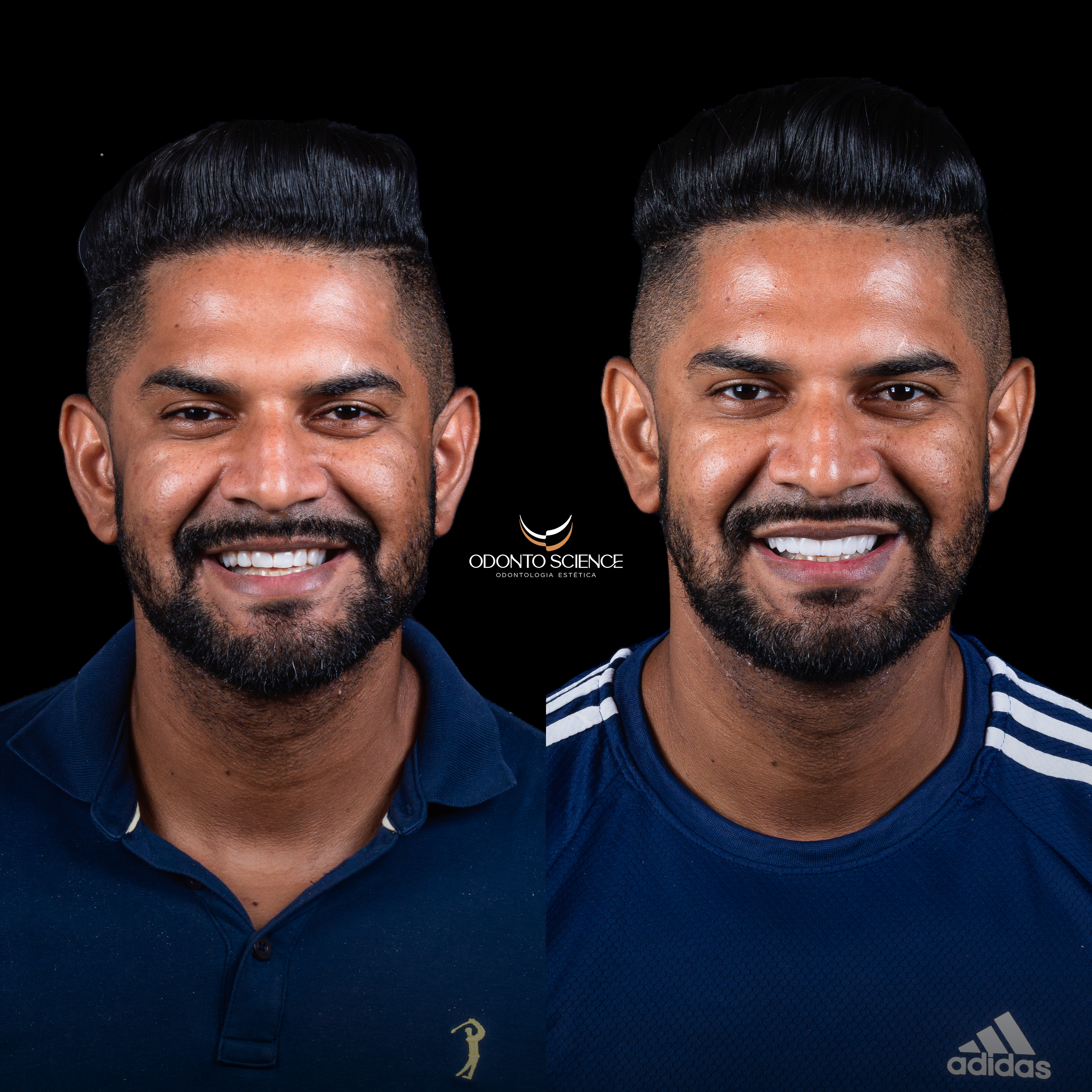 FERNANDO ANTES E DEPOIS