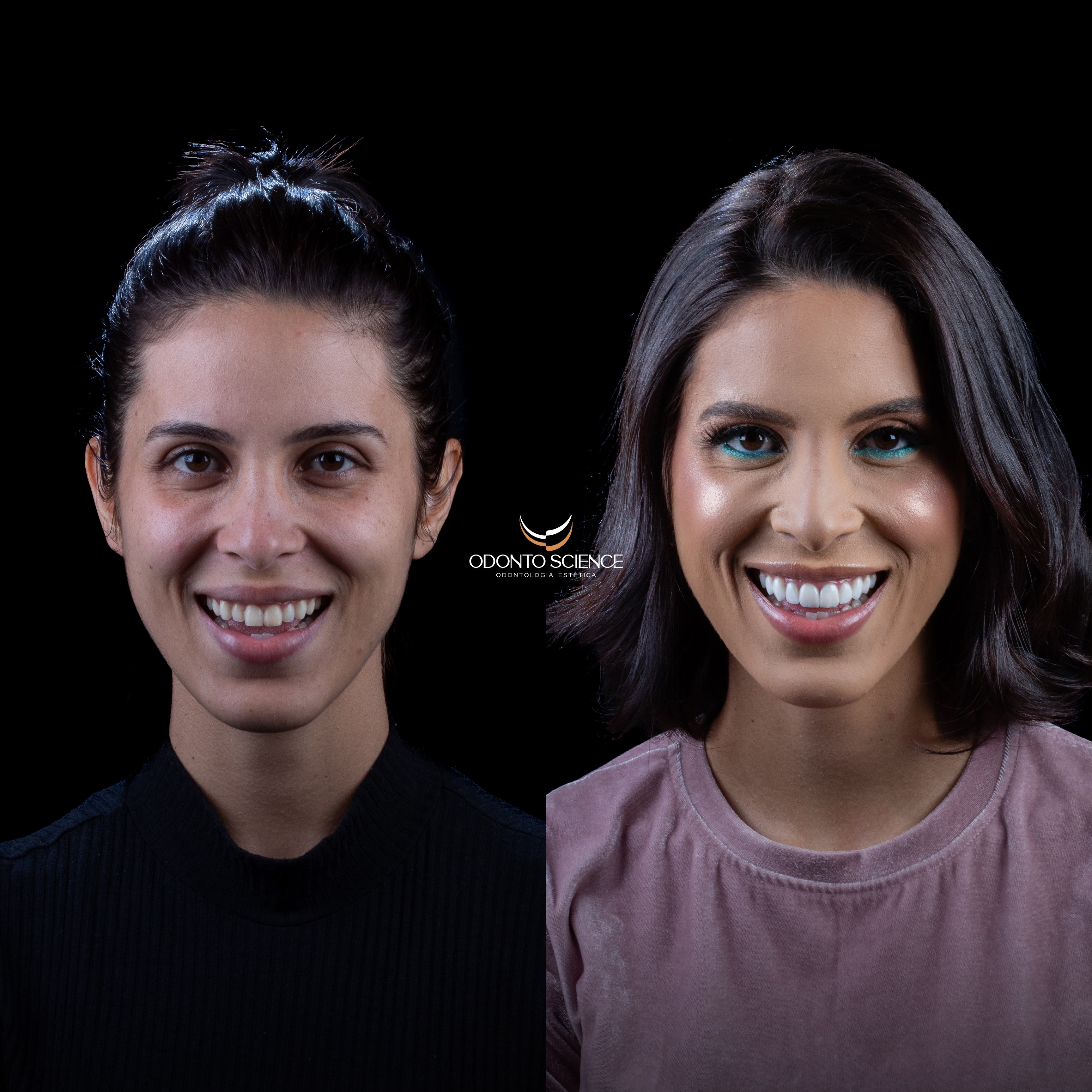 GABRIELA ANTES E DEPOIS