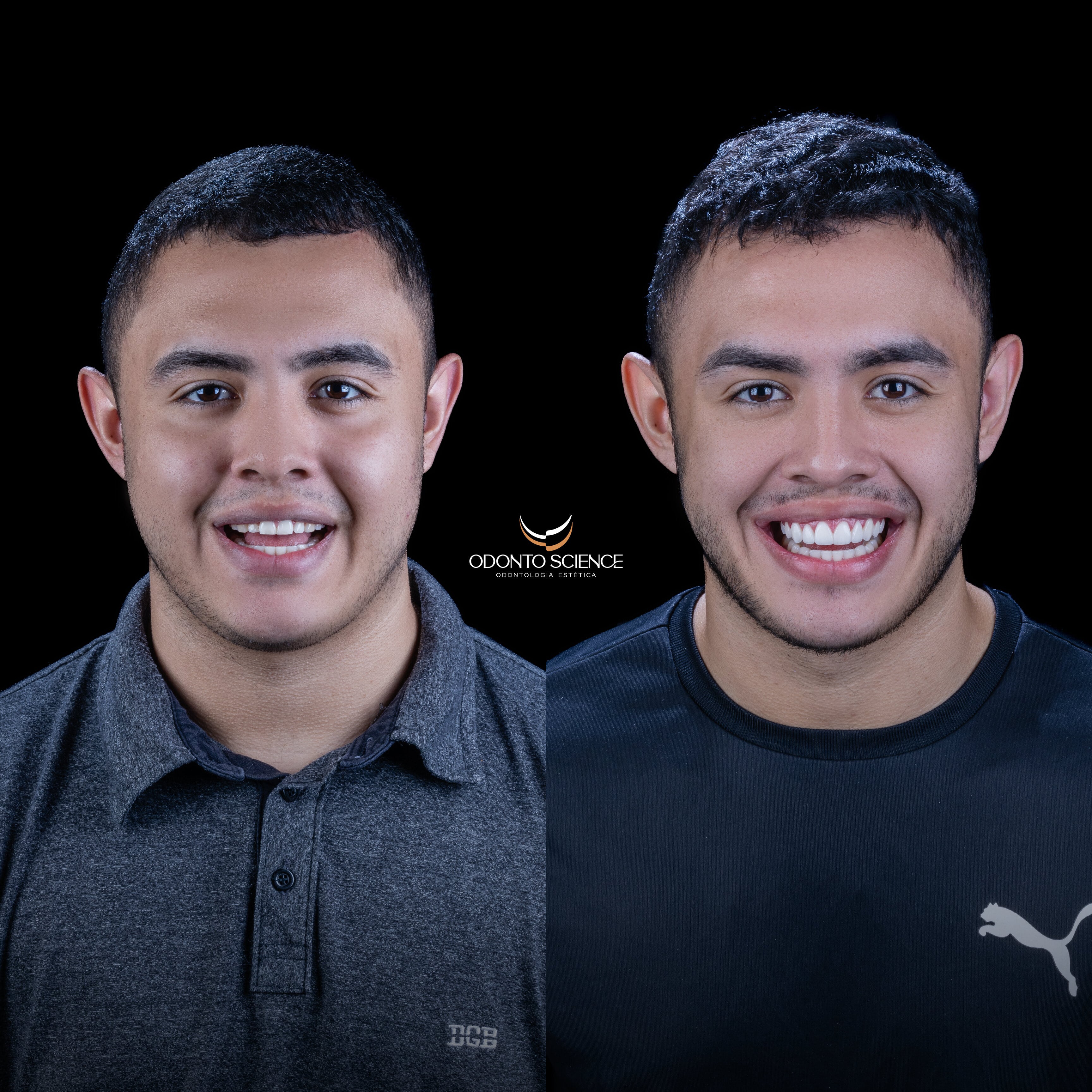 JUNIOR ANTES E DEPOIS